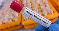 Signs of multiple sclerosis can be detected in blood 5 years before symptoms appear, new study finds. Here's why this breakthrough is important.