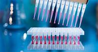 Définition | PCR - Amplification par PCR - Polymerase Chain Reaction | Futura Santé
