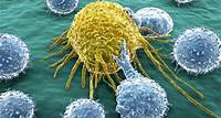 O que é Oncologia? Tipos de câncer e tratamentos - IMEB