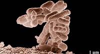E. coli bei 10000facher Vergrößerung