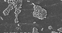 Escherichia coli Bakterien (REM, 3607fache Vergrößerung)