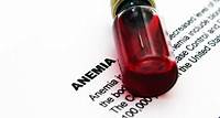Anemia macrocítica: síntomas, causas y tratamiento