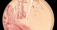 E. coli - Bakterienkolonien auf Agarplatte nach 24 h