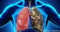 COPD: Symptome, Stadien, Therapie
