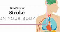 How Does a Stroke Effect the Body?