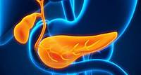 Pancreatic cysts: What they are and how they’re treated