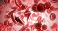 Anemia hemolítica: causas, síntomas y tratamiento