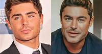 O que aconteceu com o rosto de Zac Efron? Cirurgião explica