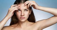 Pickel im Gesicht: Ursachen und Behandlungen unreiner Haut