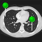 Anatomie der Lunge, des Mediastinums und des Herzens in axialer Schnittebene | e-Anatomie