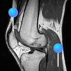 Das Knie (MRT): Anatomieatlas in medizinischer Bildgebung | e-Anatomy