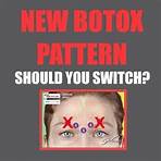New BOTOX Pattern - Should You Switch? | Dr Tim Pearce