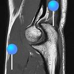 Ellenbogen MRT: normale anatomie | e-Anatomy