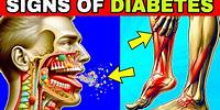 10 Unnoticed Symptoms of Diabetes