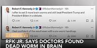 RFK Jr. Says Doctors Found Dead Worm In Brain | The View