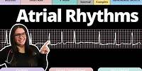 Atrial Rhythms on an EKG with Practice Qs | Circulatory System and Disease | NCLEX-RN | Nurse Cheung