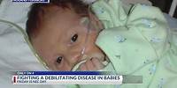 Family raises awareness for debilitating disease in babies