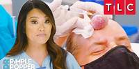 Most Frustrating Forehead Growths | Dr. Pimple Popper | TLC