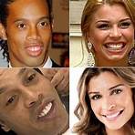 dentes dos famosos antes e depois1