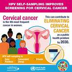 Cervical cancer wikipedia4