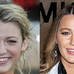 Did Blake Lively get a nose job?1