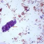 entamoeba coli trophozoite under microscope definition2