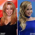 tara lipinski plastic surgery before and after4