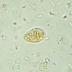giardia lamblia cyst morphology3
