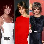 What cosmetic surgery did Lisa Rinna get?3