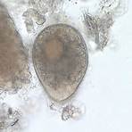 is balantidium coli a ciliate plant4