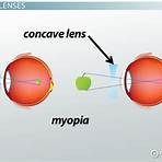uses of concave lens3