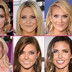 stephanie pratt plastic surgery2