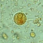 how many nuclei does an entamoeba cyst have a positive number2