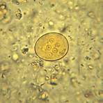 entamoeba coli cyst symptoms in humans early life3
