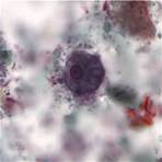 how many nuclei does an entamoeba cyst have a total of 34