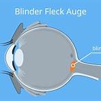 Blinder Fleck4