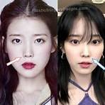 iu plastic surgery4