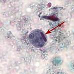 how many nuclei does an entamoeba cyst have a positive number3