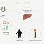 leberkrebs symptome5