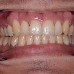 Should I get Invisalign from a dentist or orthodontist?3