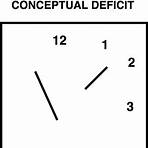 meaning of clock drawing on cognitive test4
