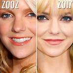anna faris plastic surgery before after list1