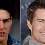 dentes dos famosos antes e depois3