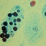 how many nuclei does an entamoeba cyst have blood tissue3