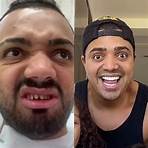 lentes dentes famosos antes e depois5