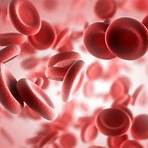 síntomas de anemia en niños2