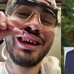 lentes dentes famosos antes e depois2