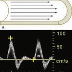 spectral analysis ultrasound1