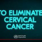 Cervical cancer wikipedia1