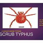 scrub typhus ppt presentation1